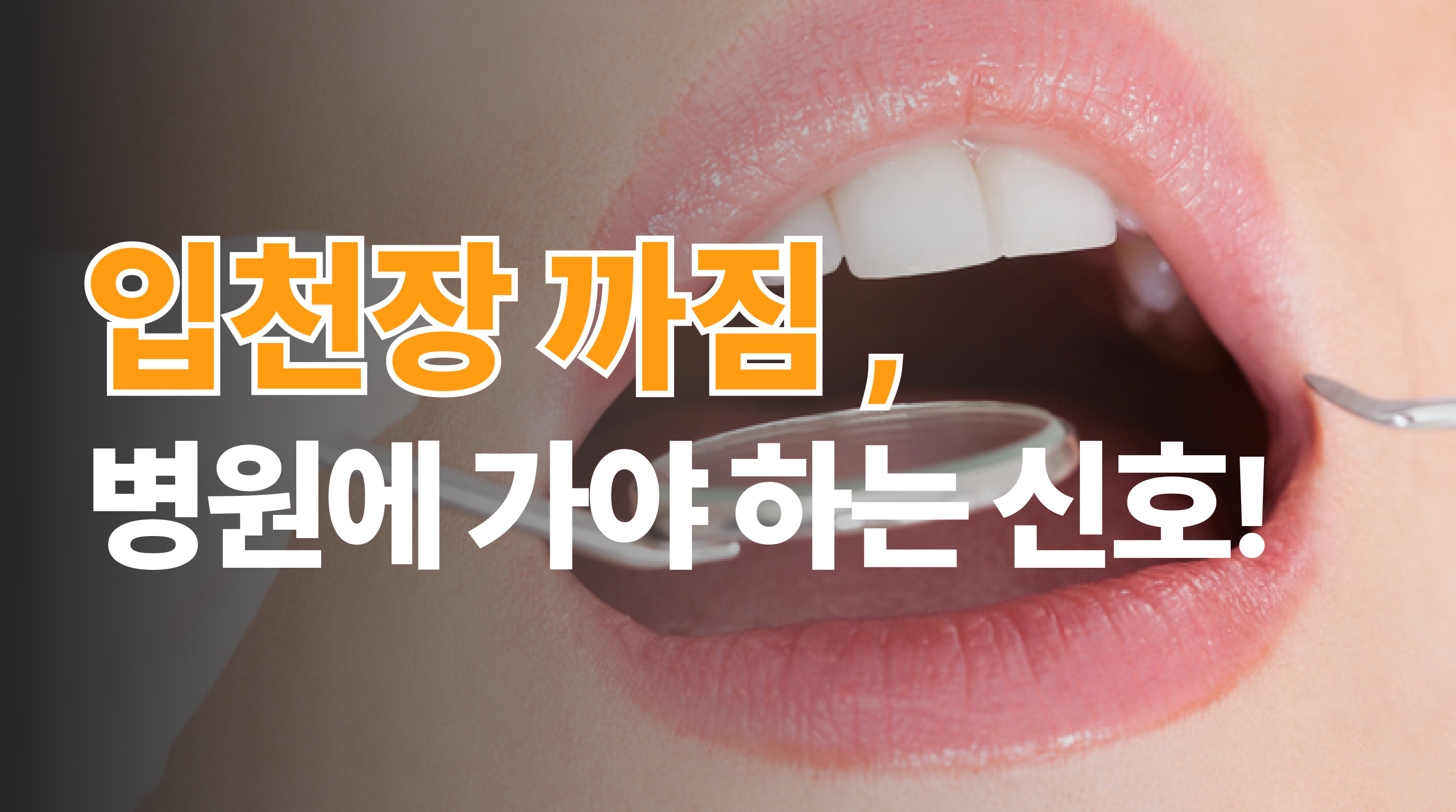입천장 까짐 연고로 버티시나요? | 병원에 가야 하는 신호
